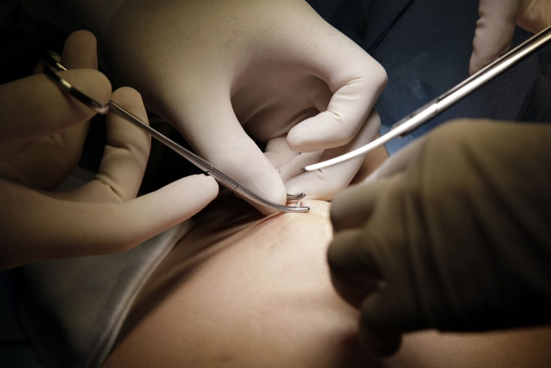 Surgery
