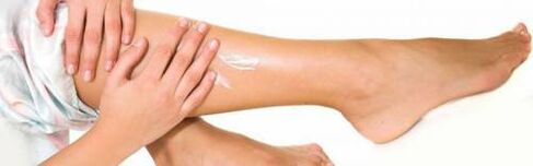 Application of medicinal cream on legs with dilated veins
