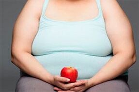 To cure varicose veins you need to lose excess weight