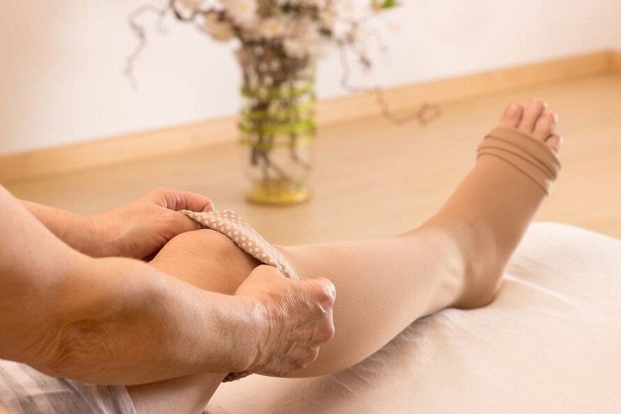 Compression stockings for varicose veins