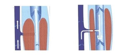correct functioning of the venous pump