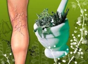 Traditional medicine in the fight against varicose veins of the lower limbs