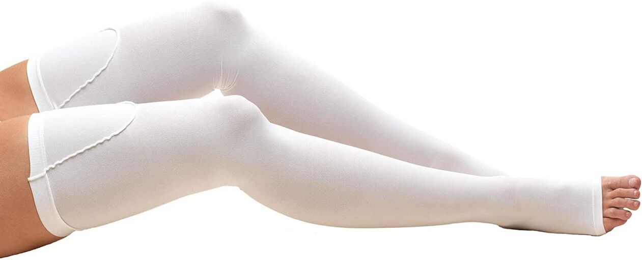 To treat varicose veins you need to wear compression stockings